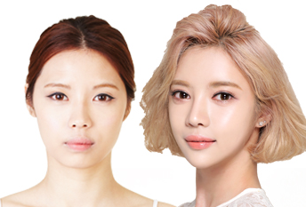 Операция на обе челюсти без фиксации